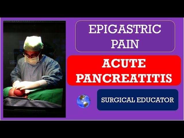 ACUTE PANCREATITIS-  How To DIAGNOSE u0026 TREAT/  EPIGASTRIC PAIN class=
