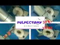 #pulpectomy
PULPECTOMY STEP BY STEP||KEDO SG BLUE FILE||SINGLE SITTING PULPECTOMY IN 4ROOT CANALS