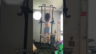 Watch How A Deadhang Corrects My Scoliosis And Hip Dysplasia