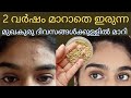 In just a few days remove pimples  dark spots in malayalam   