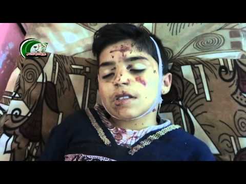 الشهيد الطفل بشار ابراهيم السعدي 11 سنة من بلدة برقاأستشهد بإنفجار أحد الألغام 16 10 2015