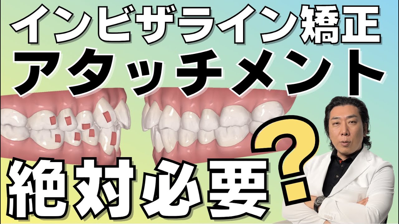 インビザライン矯正アタッチメントが必要な理由？