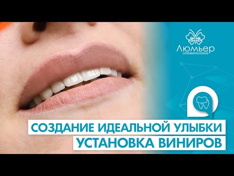 Как преобразить улыбку? Изменение цвета и формы зубов винирами.| Стоматология Люмьер Хабаровск