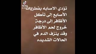 وصفه طبيه لعلاج فطريات الأظافر ومابين الأصابع وتسبب الرائحه الكريهه في الحذاء/شاكر العزيز ٢٠٢١