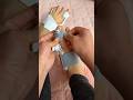 How to correct toe deformity at home 🤯👺New Viral Gadgets Smart Appliances Kitchen Utensils/ Home Inv