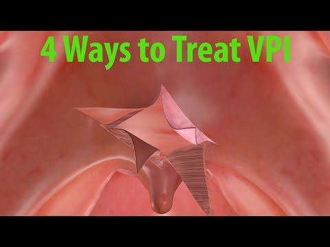 4 Ways to Treat Velopharyngeal Insufficiency (VPI)