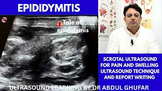 Epididymo orchitis ultrasound | epididymitis | Funiculitis ultrasound | Hydrocele ultrasound | testi
