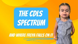 Is she severely affected? Looking at the CdLS spectrum