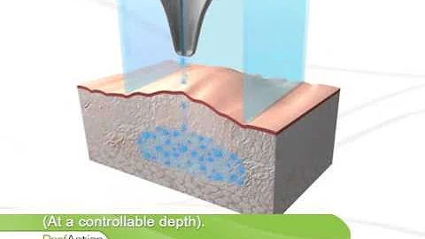 The science behind Airgent / Enerjet Device