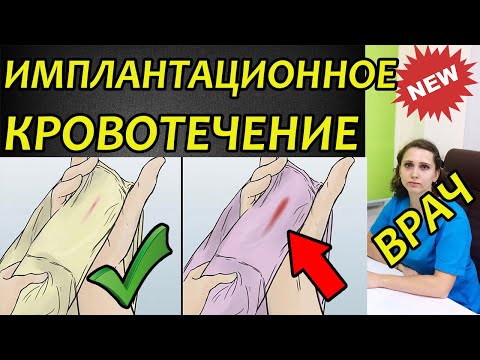 Видео: Всегда ли бывает имплантационное кровотечение?