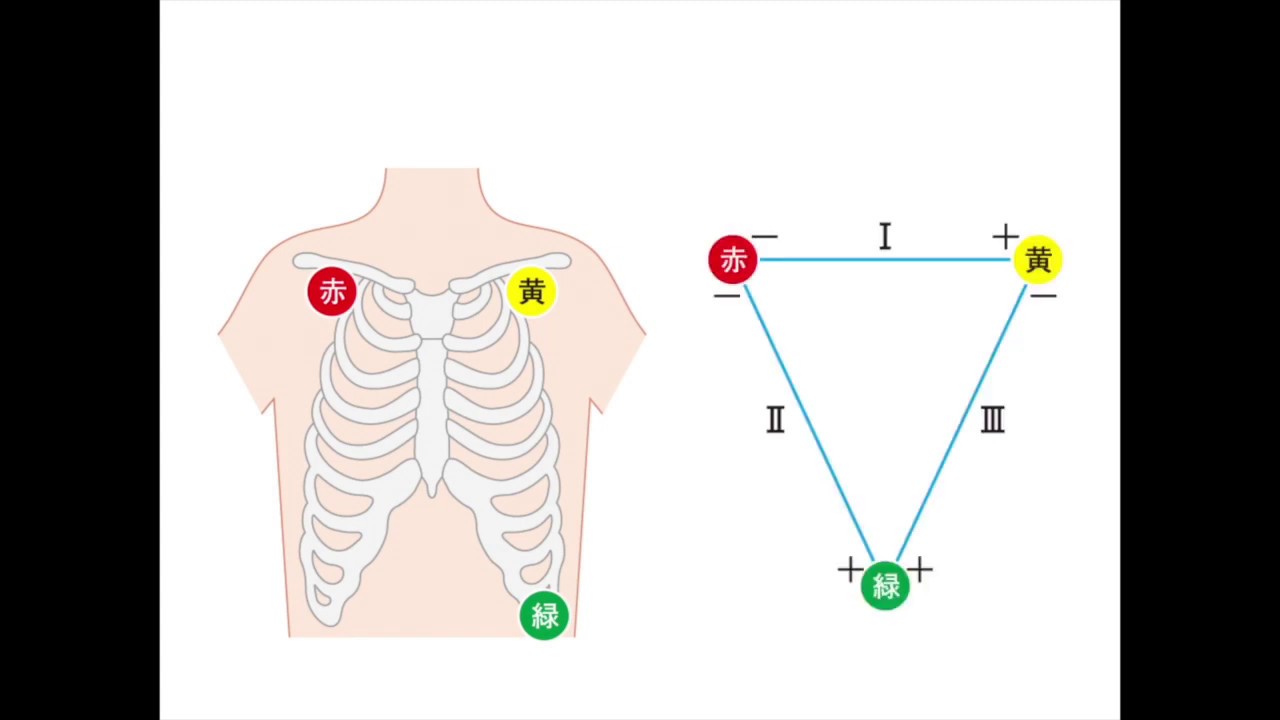 5分間のモニター心電図の読み方 基本の読み方 Youtube