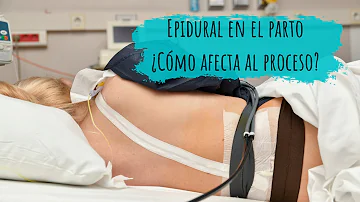 ¿Es doloroso dar a luz después de la epidural?