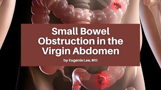 Small Bowel Obstruction in the Virgin Abdomen | The USC Trauma & Surgery Course