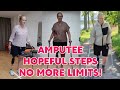 Amputee woman Life After Amputation: Walking training with mobility aids 