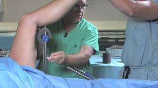 Peri-Petellar IM Nailing of the Tibia