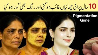 Pigmentation Treatment on Skin at Home 😍| Get Glowing Skin FAST | 100% Natural Skin Whitening Remedy