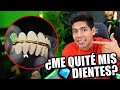 ME PUSE DIAMANTES EN LOS DIENTES... *ASÍ LOS HICIERON* - [ANTRAX] ☣