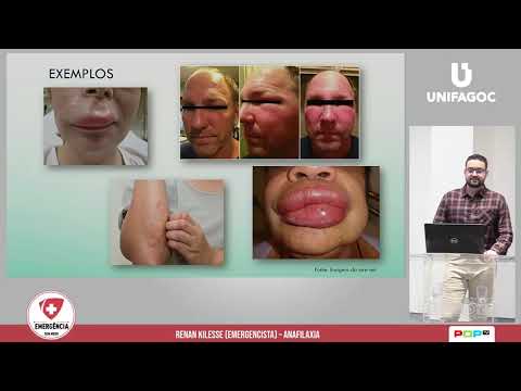 Vídeo: Anafilaxia Bifásica: Sintomas, Tratamento, Prevenção E Muito Mais