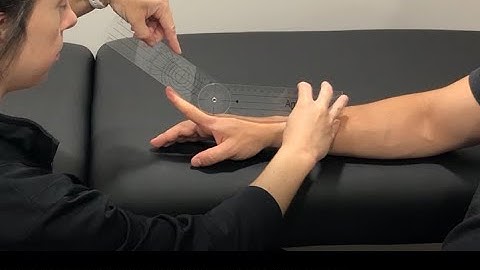 Range of Motion Measurement: Finger Metacarpophalangeal Extension