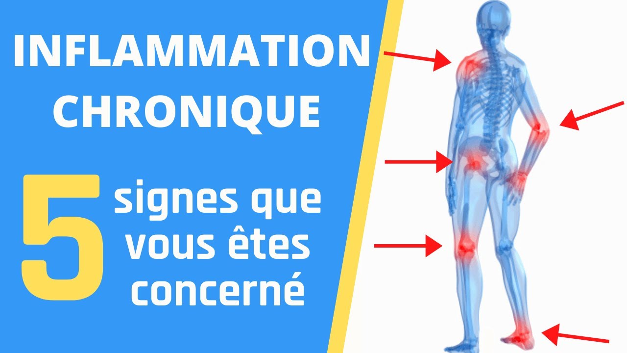 INFLAMMATION CHRONIQUE | 5 Signes Qui Montrent Que Vous Êtes Concerné
