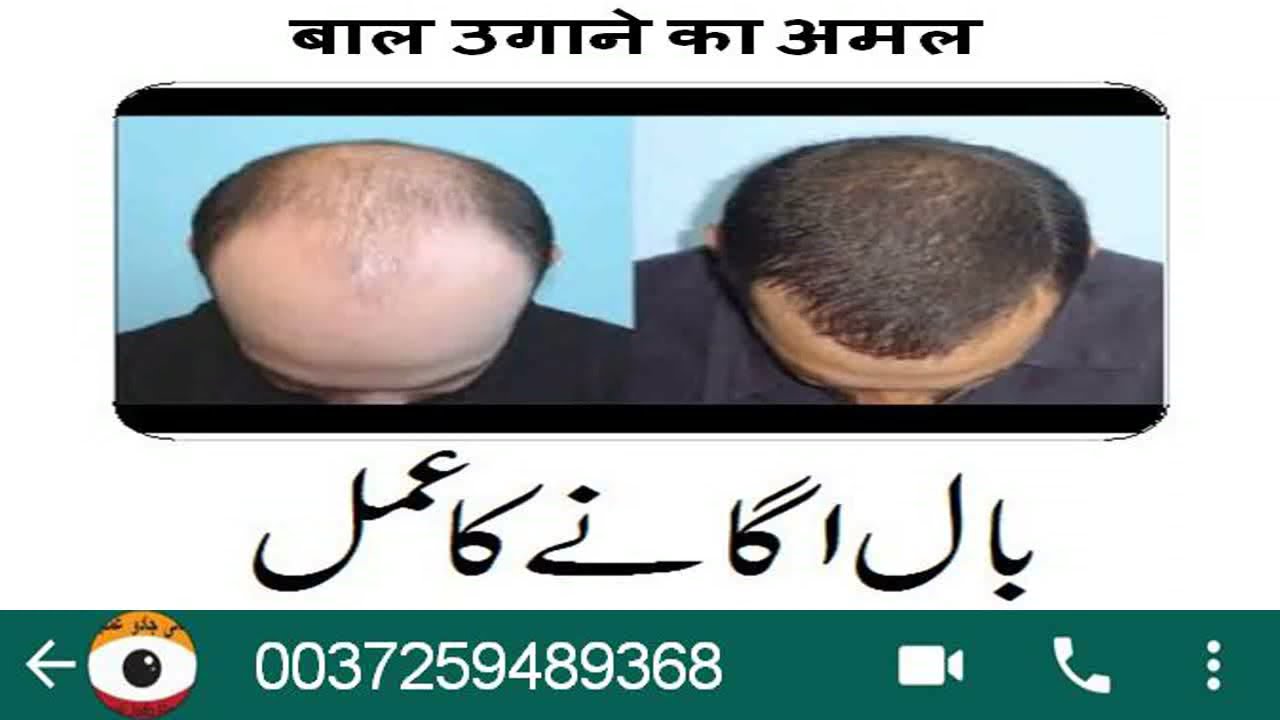 SAR K BAL UGANE KA AMAL | NOORANI | KHUWABO KI DUNYA 