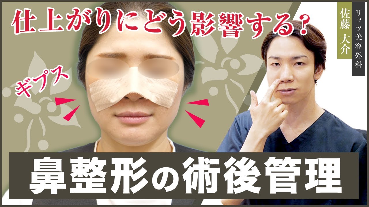 Explaining the aftercare of rhinoplasty! Do I need to wear a cast