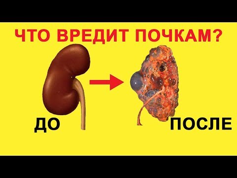 Привычки которые вредят нашим почкам