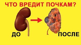 Привычки которые вредят нашим почкам...