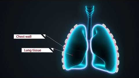 Auxiliary Pressure Monitoring on the A9 Anesthesia System