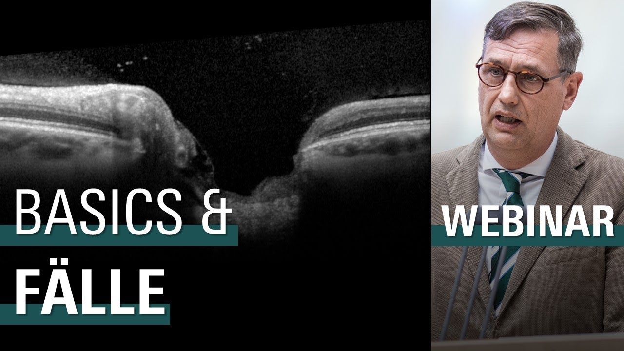 🇩🇪 Glaukom KOMPAKT: Grundlagen und Fallbeispiele