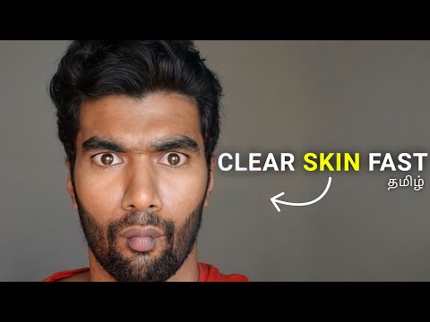 How To Have A CLEAR SKIN For Men?? | Lifestyle | In தமிழ்