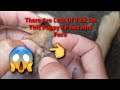Remove All Tick From Dog😰