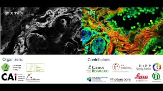 Lecture 6: Wide-field FLIM by Single Photon Counting with LINCam