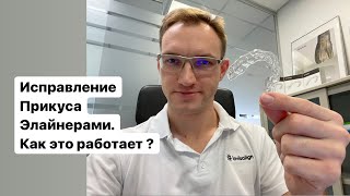 видео: Элайнеры для исправления прикуса в Ульяновске. Как изготавливаются планируются выглядят. Стас Белоус картинка: Элайнеры для исправления прикуса в Ульяновске. Как изготавливаются планируются выглядят. Стас Белоус