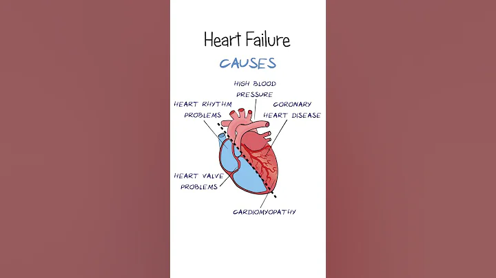 What is Heart Failure?
