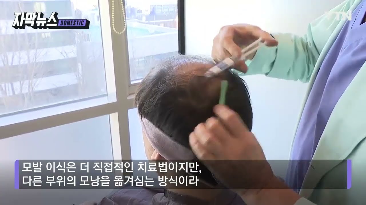 M자 이마와 정수리 탈모의 초기 증상 진단 - 무시하면 대머리로 가는 길