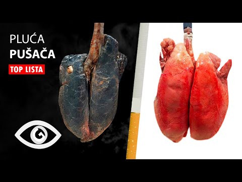 Video: Pasivno Pušenje - šteta, Utjecaj, Opasnost