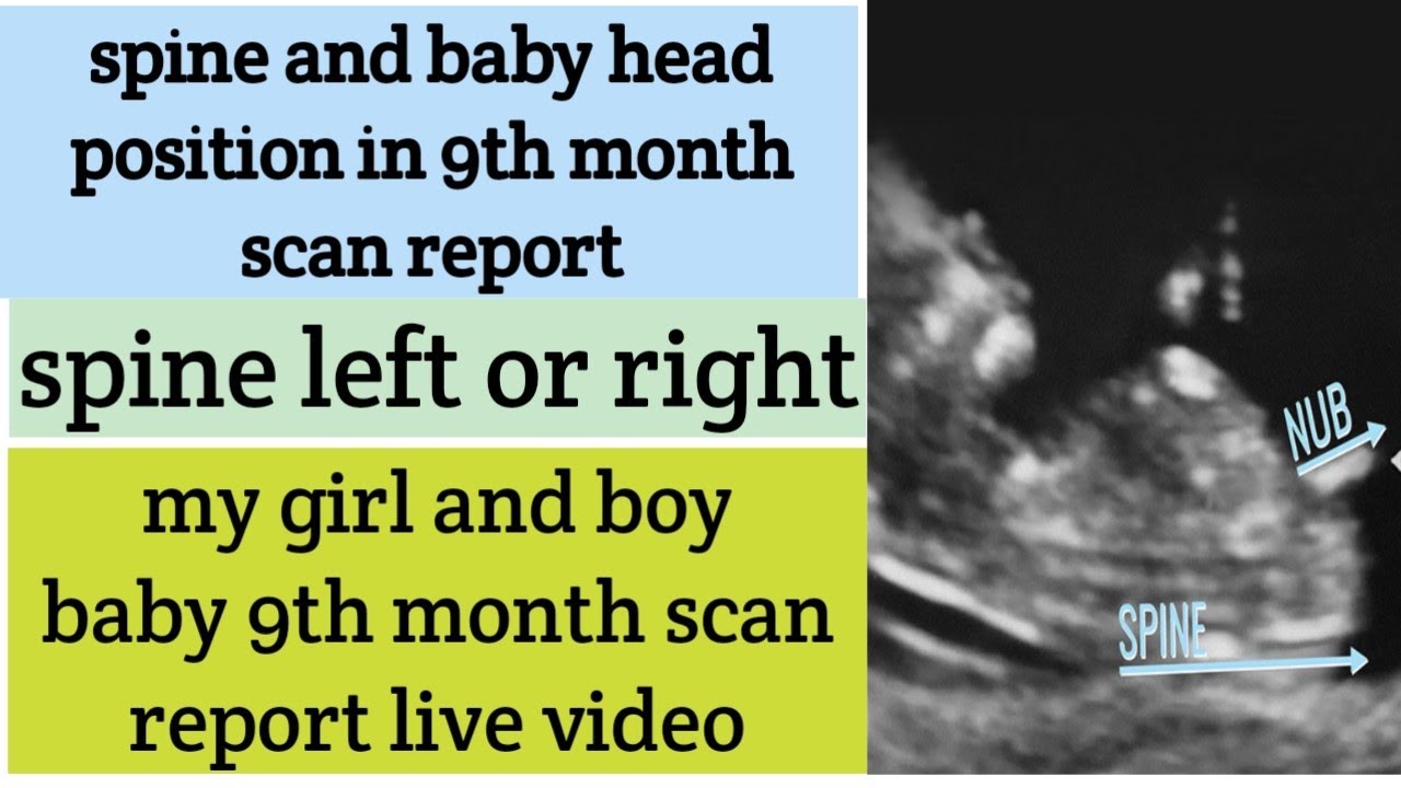 Boy and girl baby 9th month scan report spine right or left and head ...