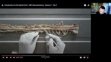 Ch16 Spinal Cord and Spinal Nerves (slides 1-12) - Spinal Cord gross anatomy