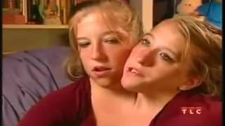 Abby brittany hensel Conjoined twins Abigail Brittany Hensel turn 16 Twins Who Share a Body