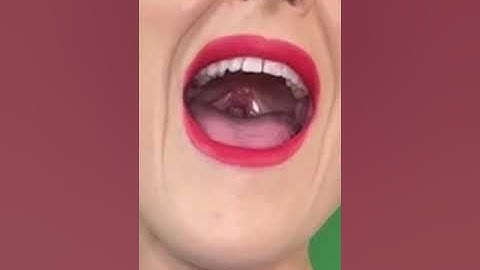 Curious about tongue position, vibrato, uvula, vowels, all the things?