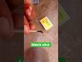 mach Stick ko sipka diya tili ko experiment #shorts #experiment