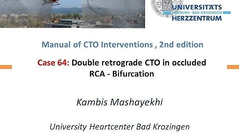 Case 64: Manual of CTO Interventions - Double retrograde for bifurcation at distal cap