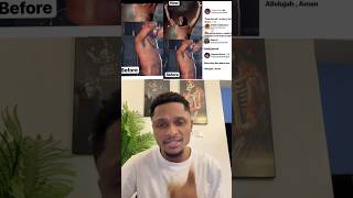 So una talk say burna boy no Dey shave armpit 😏😏