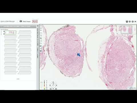 Digital Slide Pathology