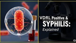 VDRL TPHA Positive Treatment in Urdu Hindi | Vdrl Test Kya Hota Hai | VDRL Negative Kaise hota hai