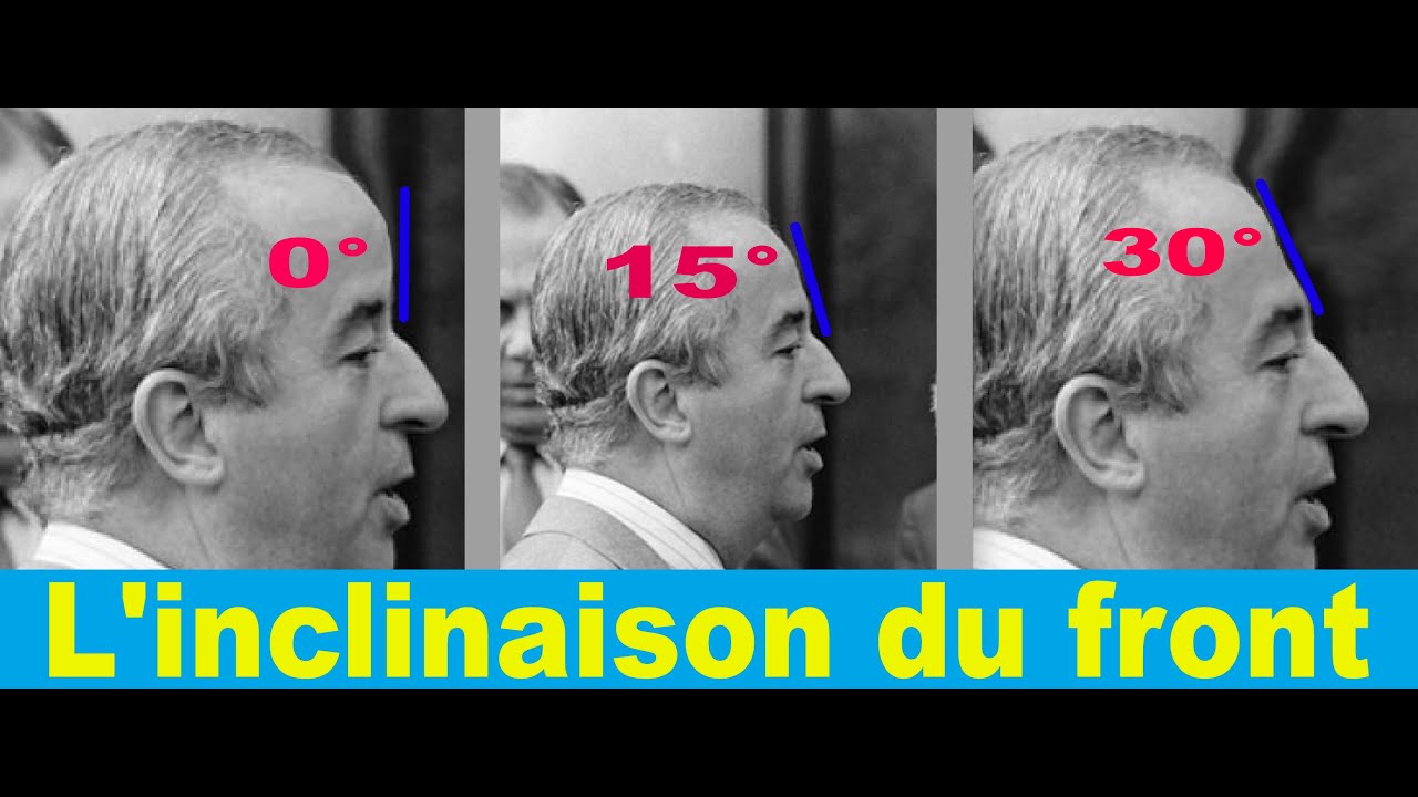 L'inclinaison du front en morphopsychologie