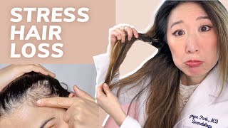 Stress Causing Your Hair Loss? Dermatologist Explains Telogen Effluvium