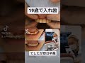 19歳で入れ歯でしたが即日卒業いたしました　前歯のことは大阪前歯セラミック矯正専門ダイヤモンド今井院長にお任せくださいませ#セラミック#入れ歯#前歯　