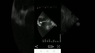 mobyDicom app screenshot 5